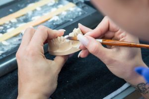 Dental technician working on veneers